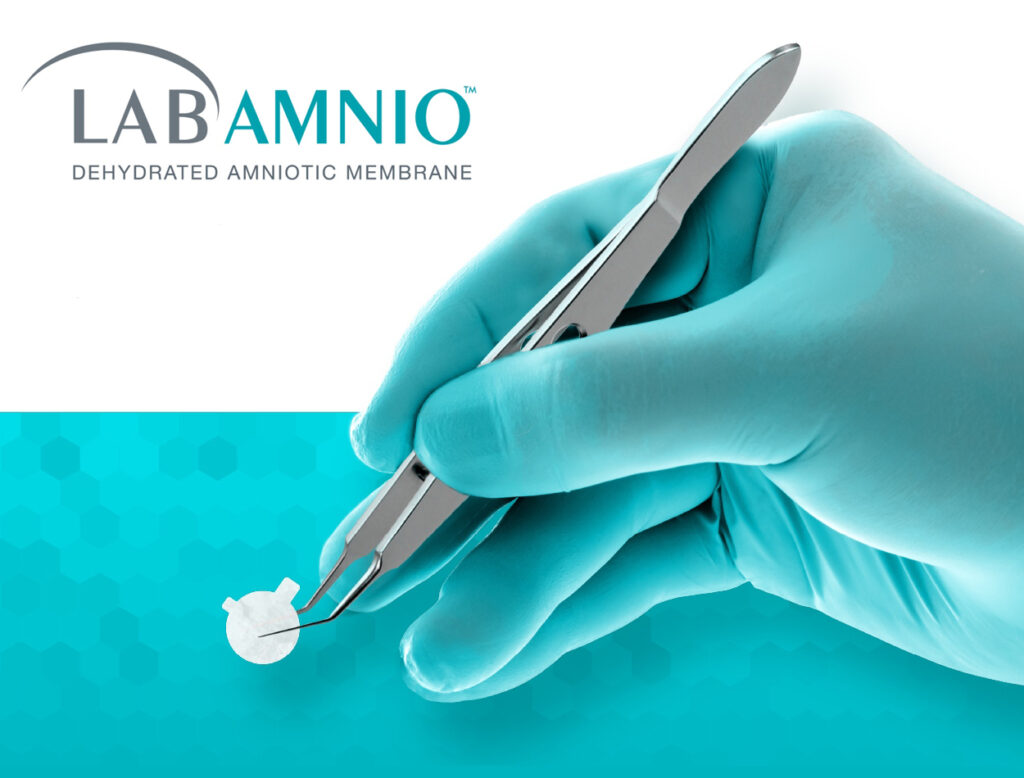 ΑΜΝΙΑΚΗ ΜΕΜΒΡΑΝΗ LABAMNIO