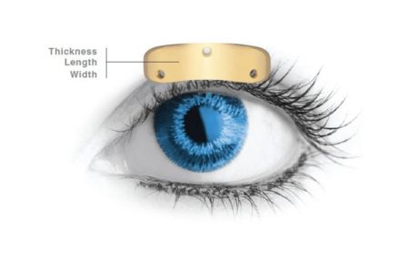 Gold Eyelid Weights
